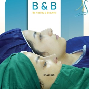 جراحی-بینی-75